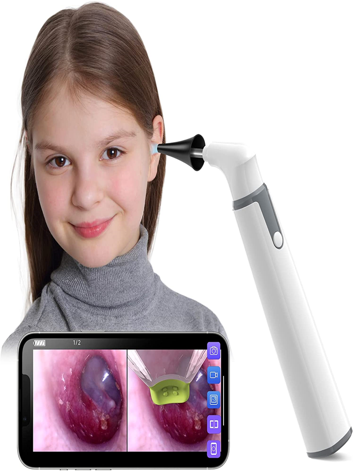 Wireless Otoscope Ear Camera with Dual View